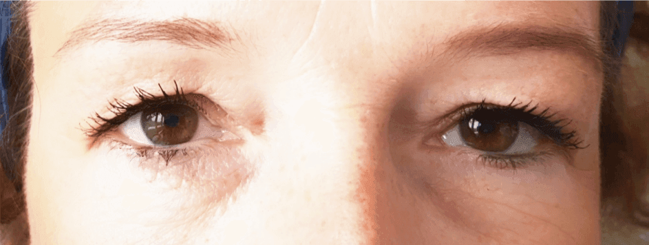 Maximale Haltbarkeit mit Elan Lamination – Wimpernverlängerung auf höchstem Niveau